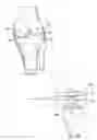 Fig. 05 - System and method for load balancing in knee replacement procedures
