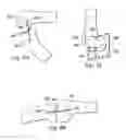 Fig. 09 - System and method for load balancing in knee replacement procedures