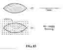 Fig. 83 - Pixel array medical systems, devices and methods