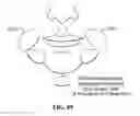 Fig. 89 - Pixel array medical systems, devices and methods