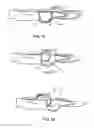 Fig. 08 - Scalpel handle having a blade shield utilizing over center spring