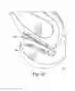 Fig. 30 - Hand held dermaplaning device and dermaplaning process