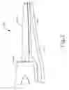 Fig. 03 - Passive dissection features for ultrasonic surgical instrument