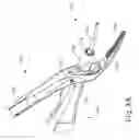 Fig. 04 - Passive dissection features for ultrasonic surgical instrument