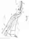 Fig. 05 - Passive dissection features for ultrasonic surgical instrument