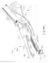 Fig. 07 - Passive dissection features for ultrasonic surgical instrument