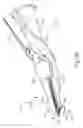Fig. 08 - Passive dissection features for ultrasonic surgical instrument