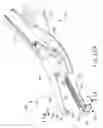 Fig. 12 - Passive dissection features for ultrasonic surgical instrument