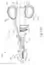 Fig. 27 - Passive dissection features for ultrasonic surgical instrument
