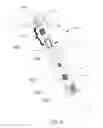 Fig. 09 - Remotely adjustable interactive bone reshaping implant