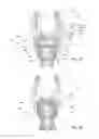 Fig. 35 - Snap-on multi-planar and mono-planar receiver assemblies having integral and multi-part multipurpose positioners for pivoting and non-pivoting retainers