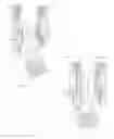 Fig. 47 - Snap-on multi-planar and mono-planar receiver assemblies having integral and multi-part multipurpose positioners for pivoting and non-pivoting retainers