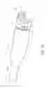 Fig. 23 - Bone anchor delivery systems and methods