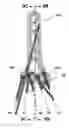 Fig. 01 - VARIABLE ANGLE CANNULATED BONE SCREW AND METHODS FOR USE THEREOF