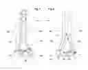 Fig. 02 - VARIABLE ANGLE CANNULATED BONE SCREW AND METHODS FOR USE THEREOF