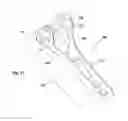 Fig. 08 - VARIABLE ANGLE CANNULATED BONE SCREW AND METHODS FOR USE THEREOF