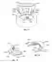 Fig. 09 - Orthopedic bone fixation assembly