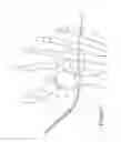 Fig. 09 - Method of correcting hallux varus joint deformity