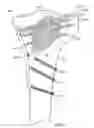 Fig. 49 - BONE FRACTURE REPAIR APPARATUS AND METHODS