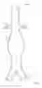 Fig. 02 - Devices and methods for anatomic mapping for prosthetic implants