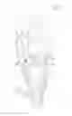 Fig. 02 - Prosthetic heart valve with cusp positioners