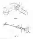 Fig. 09 - Expanding interbody implant and articulating inserter and method