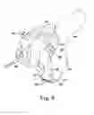 Fig. 07 - System including femoral augment trials and method of performing an orthopaedic joint replacement procedure