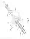 Fig. 09 - System including femoral augment trials and method of performing an orthopaedic joint replacement procedure
