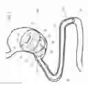 Fig. 02 - A DEVICE FOR TREATING OBESITY AND A CORRESPONDING DELIVERY SYSTEM