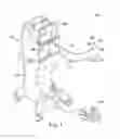 Fig. 02 - Automated viscous fluid control in vitreoretinal surgery