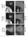 Fig. 08 - Topical sodium nitrite formulation