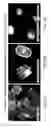 Fig. 09 - CORE-SHELL PARTICLE FORMULATION FOR DELIVERING MULTIPLE THERAPEUTIC AGENTS