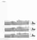 Fig. 05 - Pharmaceutical composition for preventing or treating immune diseases or inflammatory diseases, containing biguanide derivative compound as active ingredient