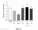 Fig. 45 - Methods of reducing or preventing oxidation of small dense LDL or membrane polyunsaturated fatty acids
