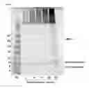 Fig. 06 - Methods and compositions for attenuating allergenicity in protein products