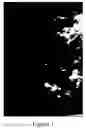 Fig. 02 - Methods of reducing mammographic breast density and/or breast cancer risk