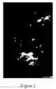 Fig. 03 - Methods of reducing mammographic breast density and/or breast cancer risk