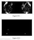 Fig. 24 - Methods of reducing mammographic breast density and/or breast cancer risk