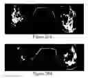 Fig. 27 - Methods of reducing mammographic breast density and/or breast cancer risk