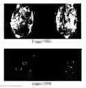 Fig. 28 - Methods of reducing mammographic breast density and/or breast cancer risk