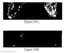 Fig. 29 - Methods of reducing mammographic breast density and/or breast cancer risk