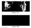 Fig. 30 - Methods of reducing mammographic breast density and/or breast cancer risk