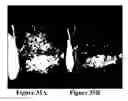Fig. 34 - Methods of reducing mammographic breast density and/or breast cancer risk