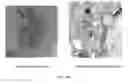 Fig. 35 - GENE MODIFIED IMMUNE EFFECTOR CELLS AND ENGINEERED CELLS FOR EXPANSION OF IMMUNE EFFECTOR CELLS
