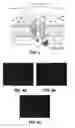 Fig. 06 - Bioengineered adipocytes for the light-controlled release of insulin and other peptides