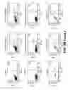 Fig. 08 - METHODS OF CARDIAC REPAIR