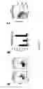 Fig. 22 - COMPOSITIONS AND METHODS FOR THE PREVENTION AND TREATMENT OF AUTOIMMUNE CONDITIONS