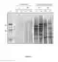 Fig. 02 - Pertussis vaccines and methods of making and using