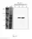 Fig. 07 - Pertussis vaccines and methods of making and using