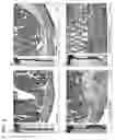 Fig. 10 - Targeted Delivery Platform for Delivery of Therapeutics